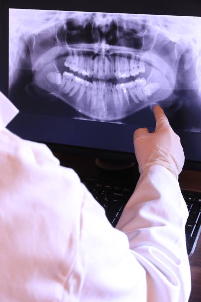 Best Chipped Tooth Repair Near Me  in Lake Katrine, NY