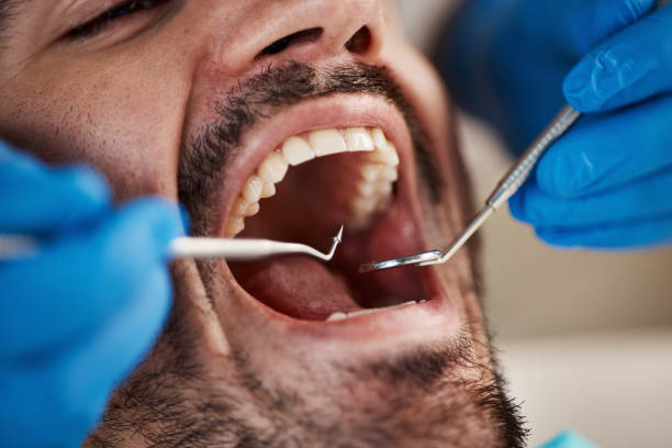 Best Cracked Tooth Emergency Dentist  in Lake Katrine, NY