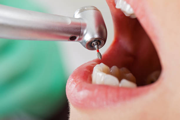 Best Urgent Tooth Repair  in Lake Katrine, NY